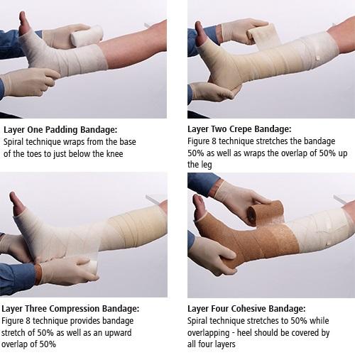 Hartmann FourPress 4-layer Compression Bandaging System Meridian Medical Supply Hartmann FourPress 4-layer Compression Bandaging System Meridian Medical Supply